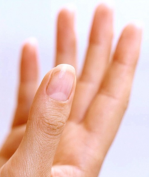 Даже у элемента ногтя есть своё имя. /Фото: nailcouture.livejournal.com Даже у элемента ногтя есть своё имя. /Фото: nailcouture.livejournal.com