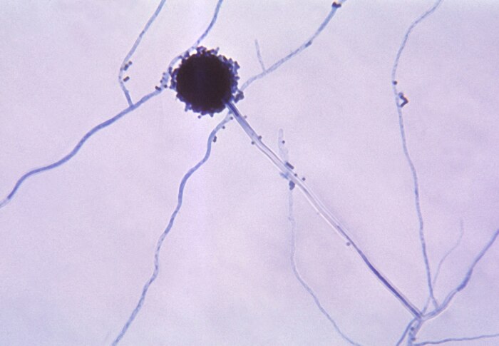 Конидий у Aspergillus niger. Фото: wikipedia.org. Конидий у Aspergillus niger. Фото: wikipedia.org.