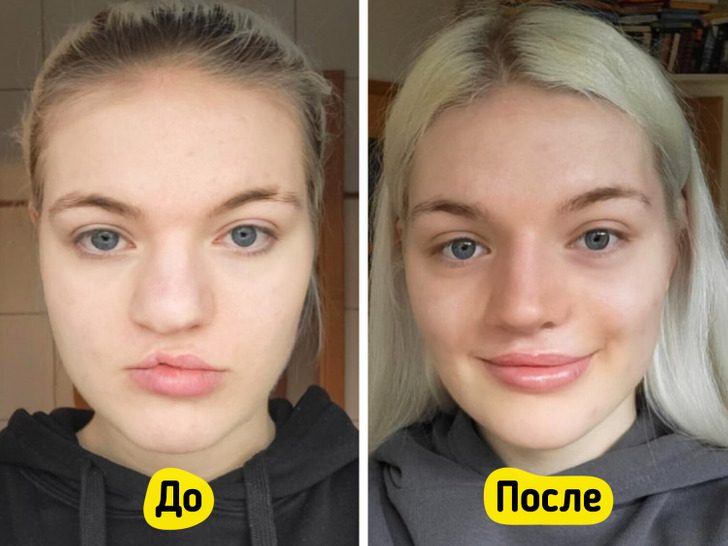 Невероятные фото «до и после» преображения