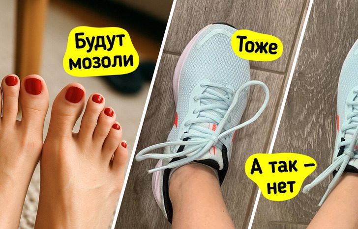 Как носить новые туфли и забыть о мозолях
