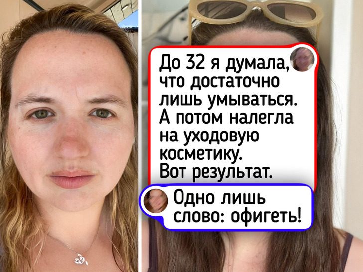 Люди, которые начали ухаживать за кожей, и результат нас поразил