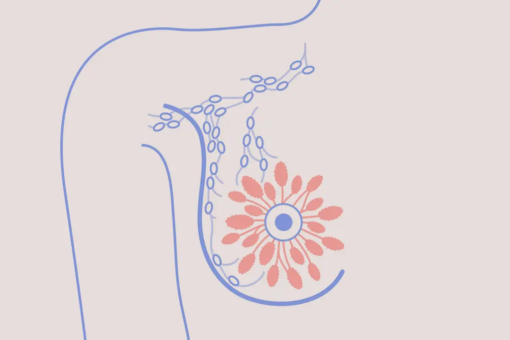 5 мифов о раке молочной железы и не только